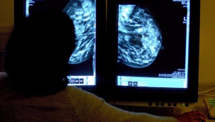 Breast cancer tumours 'larger' in overweight women