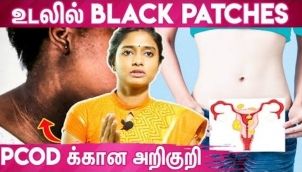 How To Treat Black Patches - Dr Archan Skin Care